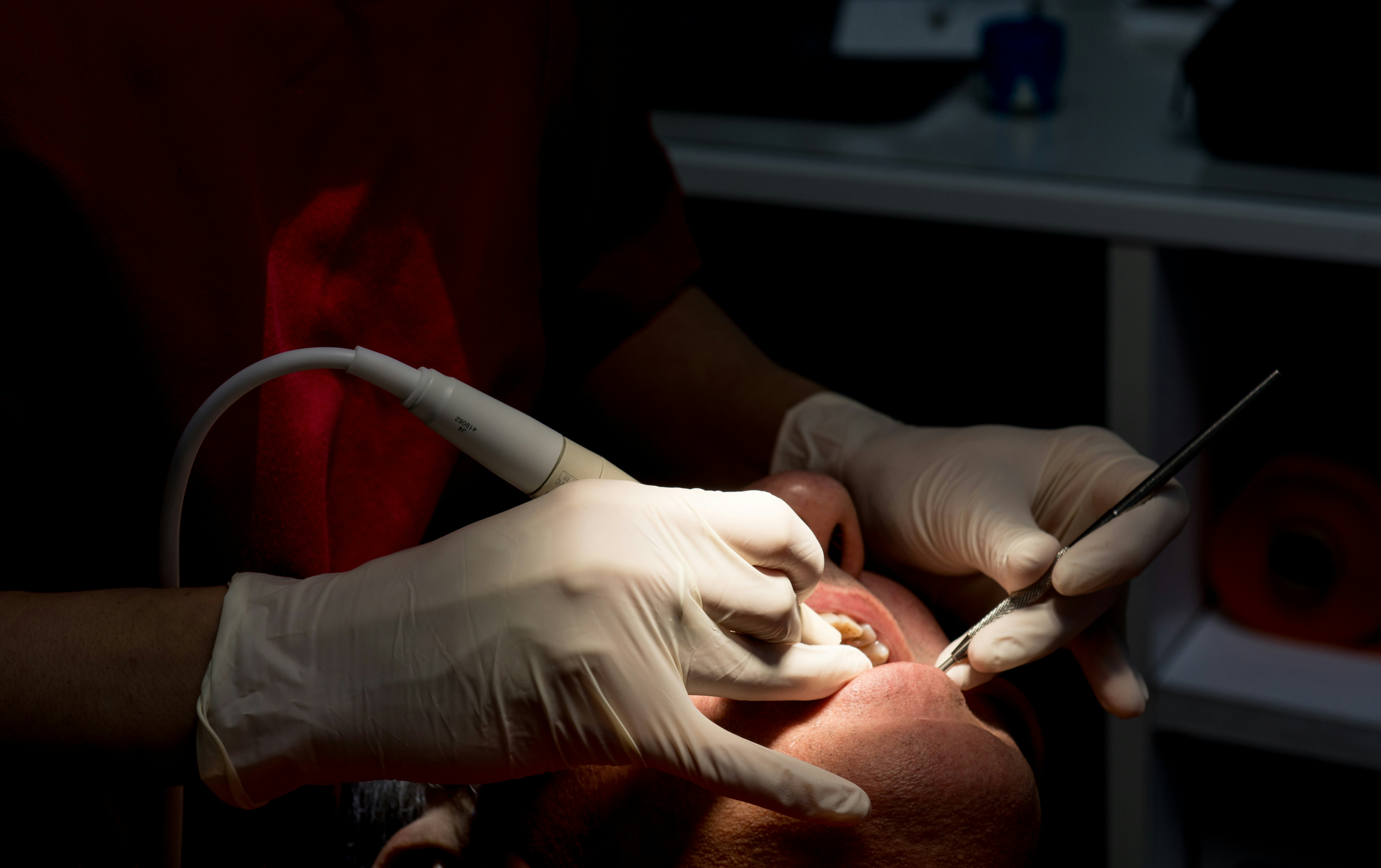 estrazione dentale
