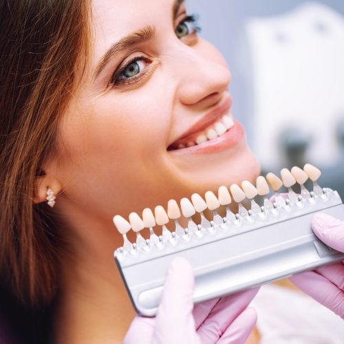 Come funziona lo sbiancamento denti dal dentista